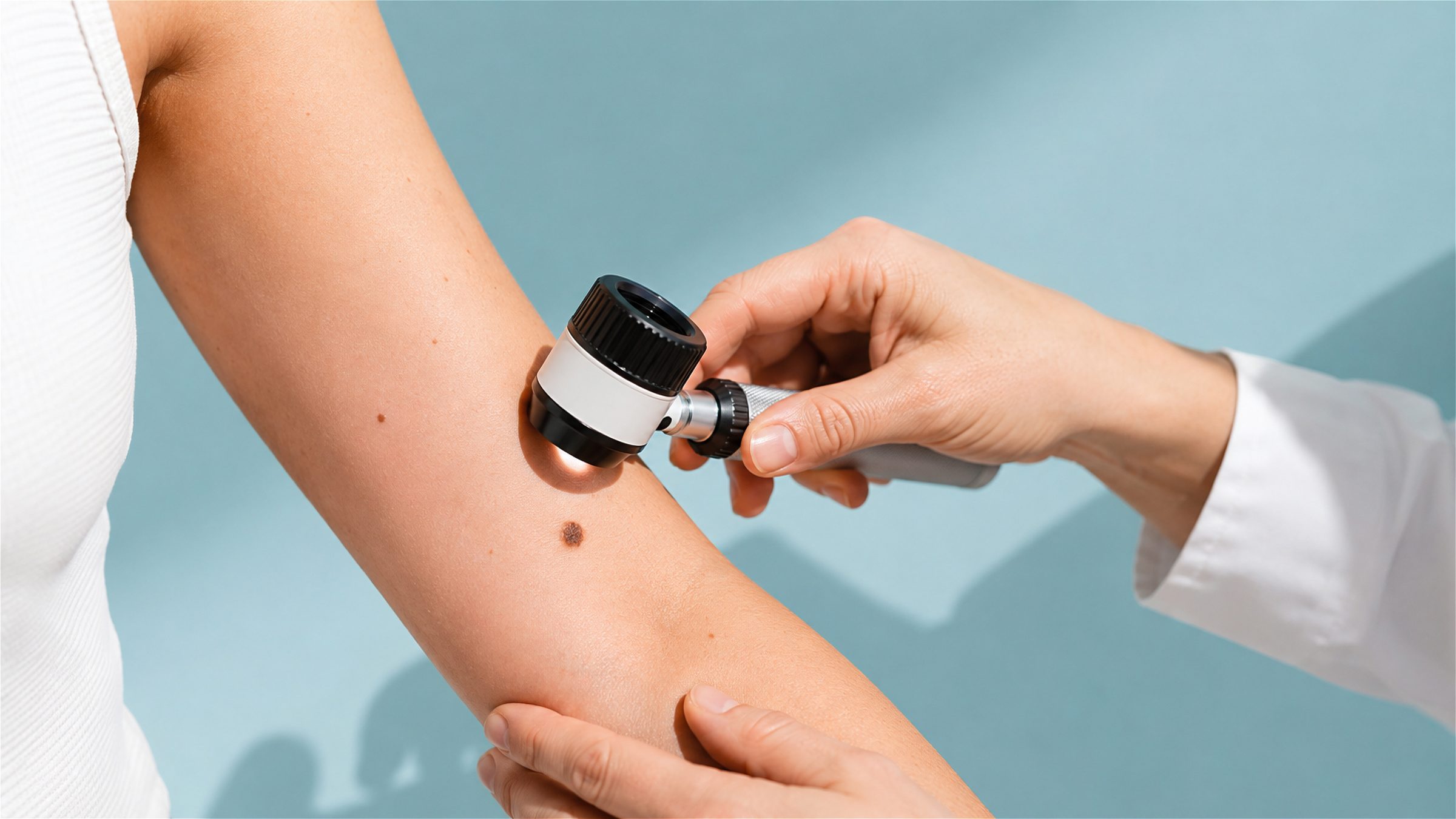 Untersuchung eines Muttermals am Arm mit dem Dermatoskop