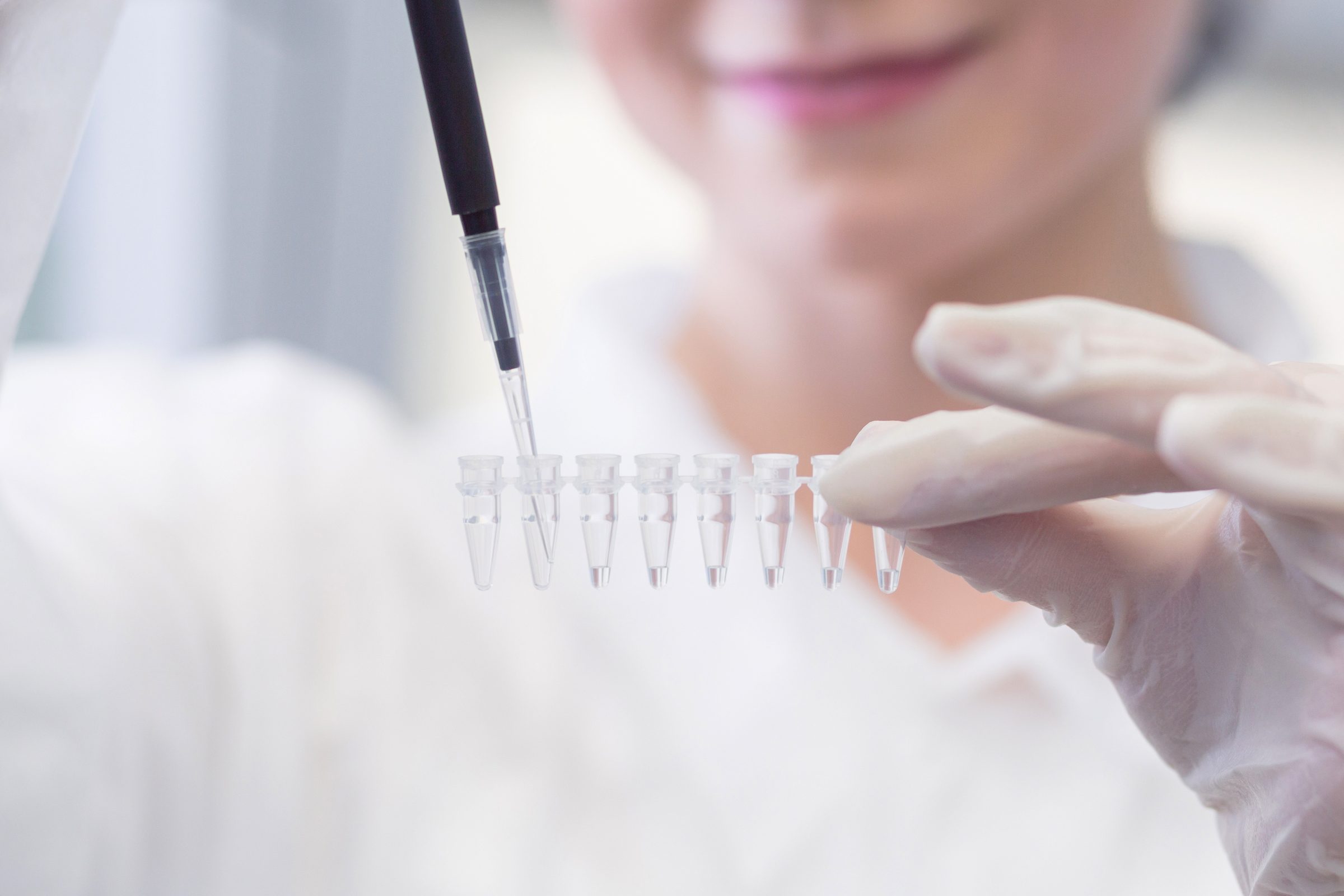 Probenvorbereitung für die PCR-Pilzdiagnostik im Labor